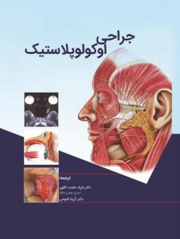 جراحی اوکولوپلاستیک